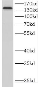 CDON Rabbit Polyclonal Antibody
