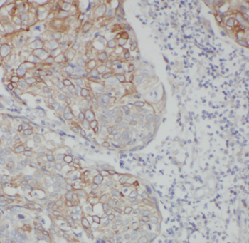CEACAM5 Antibody