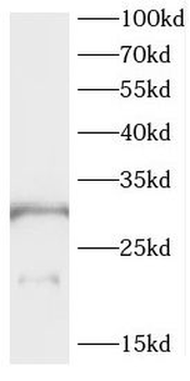 CEACAM21 Antibody