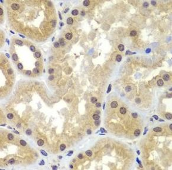 CEBPG Rabbit Polyclonal Antibody