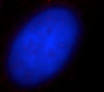 CENPJ Rabbit Polyclonal Antibody