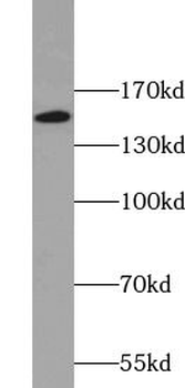 CENPJ Rabbit Polyclonal Antibody