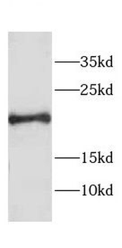 CETN1 Rabbit Polyclonal Antibody