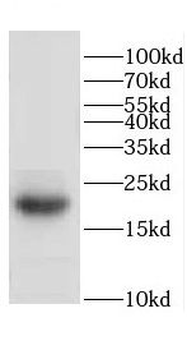 CETN2 Rabbit Polyclonal Antibody