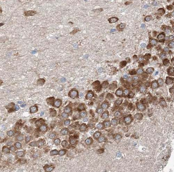 CETN2 Rabbit Polyclonal Antibody