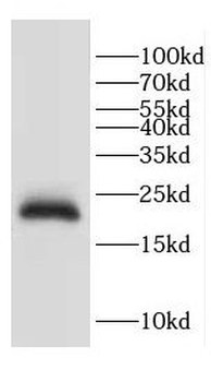 CETN3 Rabbit Polyclonal Antibody