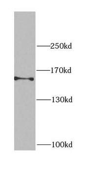 CEP164 Antibody