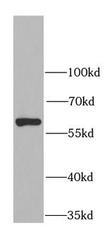 CES1 Rabbit Polyclonal Antibody
