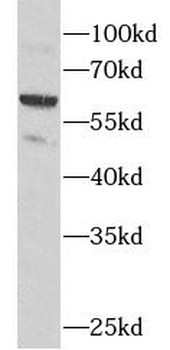 CES2 Rabbit Polyclonal Antibody