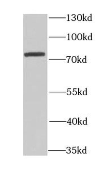 CETP Rabbit Polyclonal Antibody