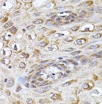 CETP Rabbit Polyclonal Antibody