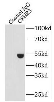 CFHR3 Rabbit Polyclonal Antibody