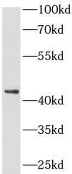 CFHR3 Rabbit Polyclonal Antibody