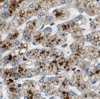 CFHR3 Rabbit Polyclonal Antibody