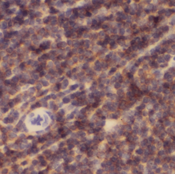 CFP Rabbit Polyclonal Antibody