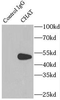 CHAT Rabbit Polyclonal Antibody