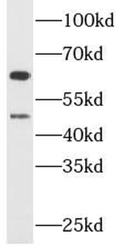 CHAT Rabbit Polyclonal Antibody
