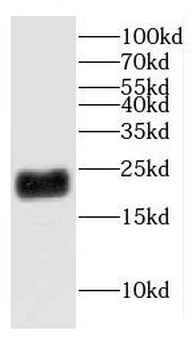 CHCHD4 Rabbit Polyclonal Antibody