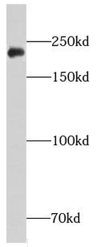 CHD3 Rabbit Polyclonal Antibody