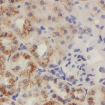 CHD3 Rabbit Polyclonal Antibody