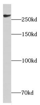 CHD4 Rabbit Polyclonal Antibody