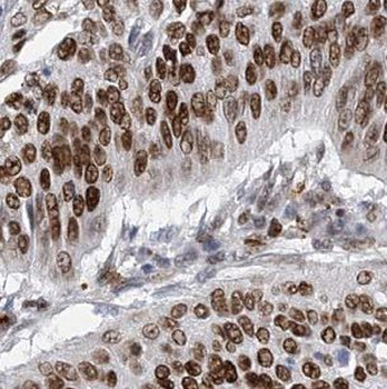 CHD4 Rabbit Polyclonal Antibody