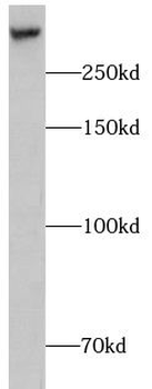 CHD9 Rabbit Polyclonal Antibody