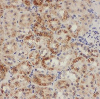 CHD9 Rabbit Polyclonal Antibody