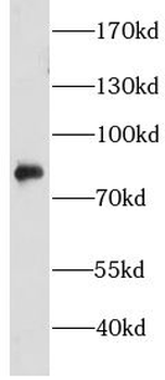 CHFR Rabbit Polyclonal Antibody