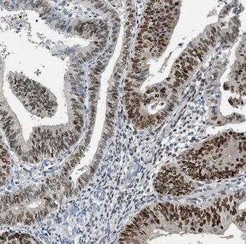 CHFR Rabbit Polyclonal Antibody