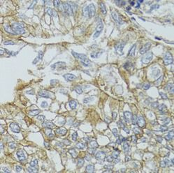 CHMP4B Rabbit Polyclonal Antibody