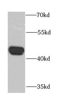 CHRFAM7A Rabbit Polyclonal Antibody