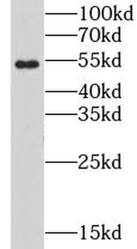 CHRNB1 Rabbit Polyclonal Antibody