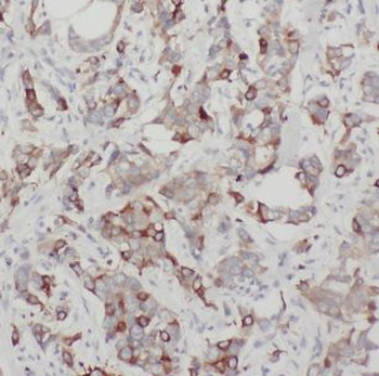 CHST3 Antibody