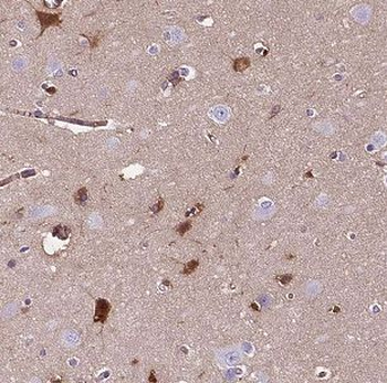 SLC5A7 Rabbit Polyclonal Antibody