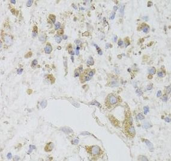 CIAPIN1 Antibody