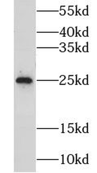 CIDEA Rabbit Polyclonal Antibody
