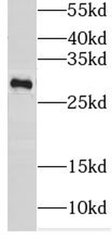 SARNP Antibody