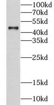 CS Rabbit Polyclonal Antibody