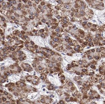 CS Rabbit Polyclonal Antibody