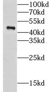 CKMT1A Rabbit Polyclonal Antibody