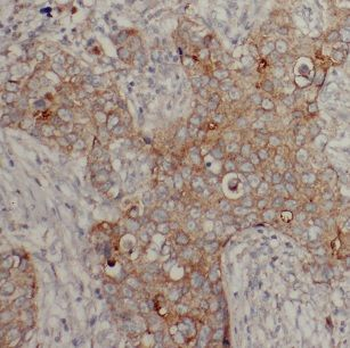CKMT1A Rabbit Polyclonal Antibody