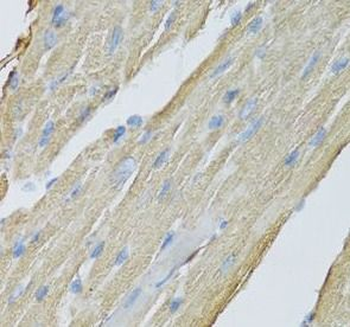 CKMT2 Rabbit Polyclonal Antibody