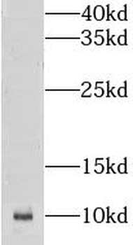 CKS2 Rabbit Polyclonal Antibody