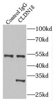 CLDN18 Rabbit Polyclonal Antibody