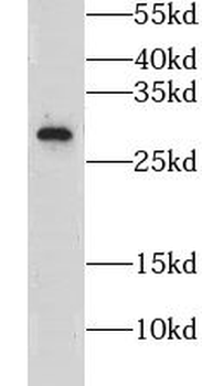 CLDN18 Rabbit Polyclonal Antibody