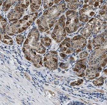 CLDN18 Rabbit Polyclonal Antibody