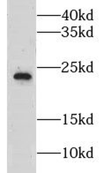 CLEC3B Rabbit Polyclonal Antibody