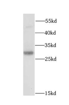CLIC4 Rabbit Polyclonal Antibody