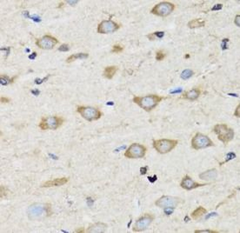 CLIC4 Rabbit Polyclonal Antibody